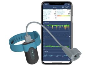 Wearable Pulse Oximeters